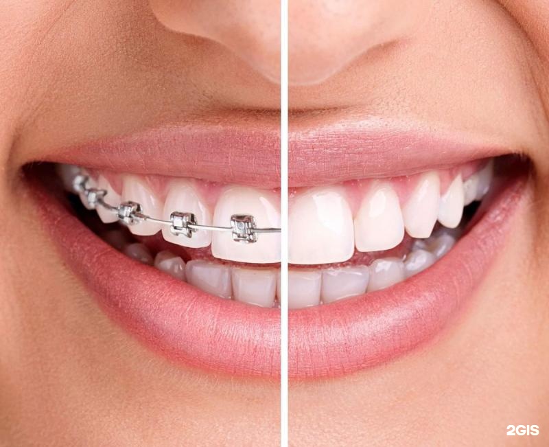 Выше гор Инегень - фото 35