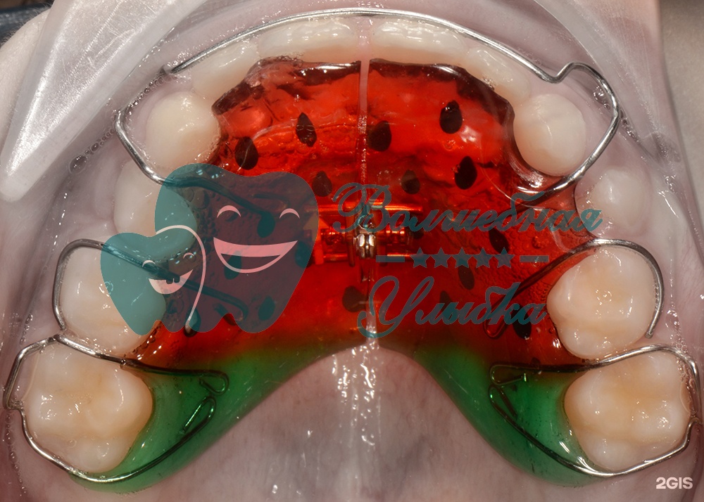 Выше гор Инегень - фото 40