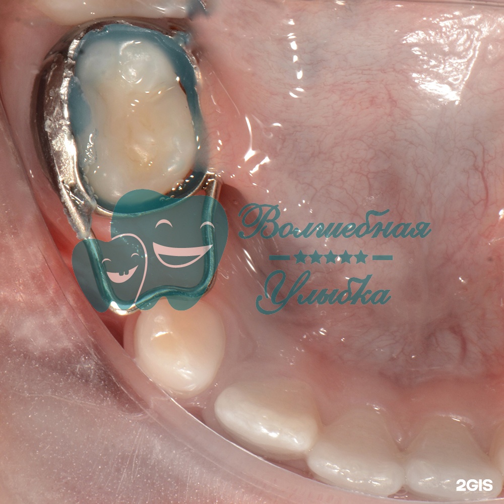 Выше гор Инегень - фото 43