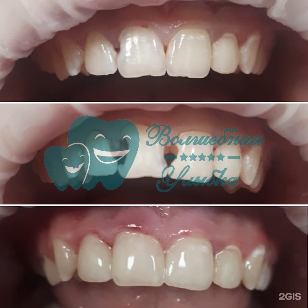 Выше гор Инегень - фото 51