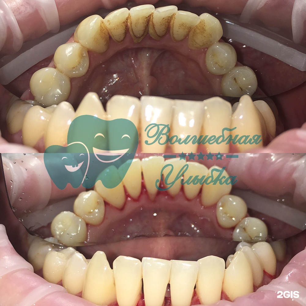 Выше гор Инегень - фото 54