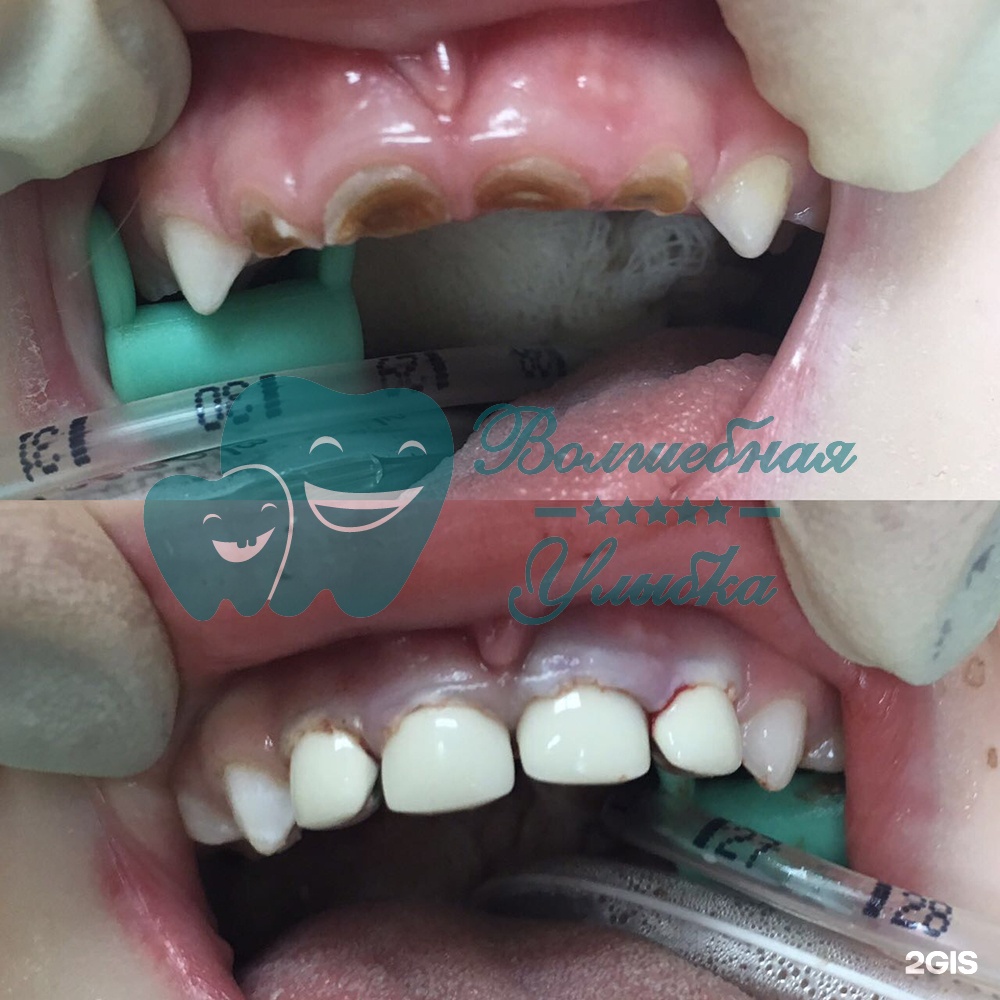 Выше гор Инегень - фото 55