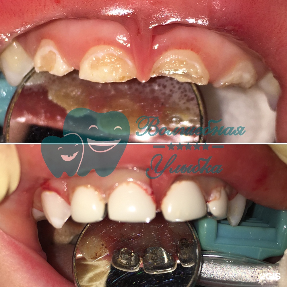 Выше гор Инегень - фото 56