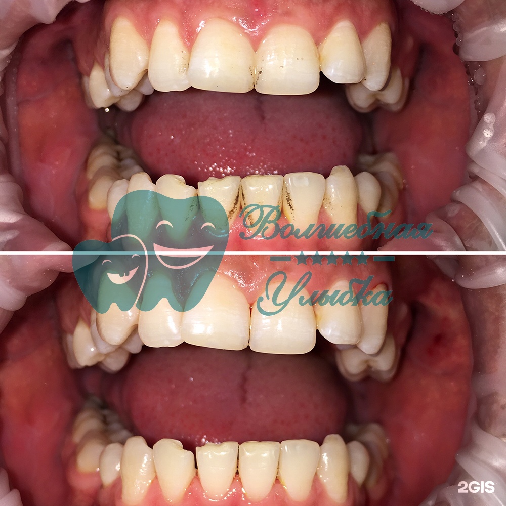 Выше гор Инегень - фото 58