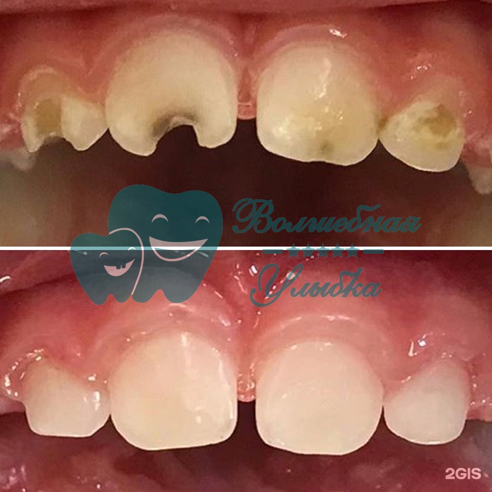 Выше гор Инегень - фото 60