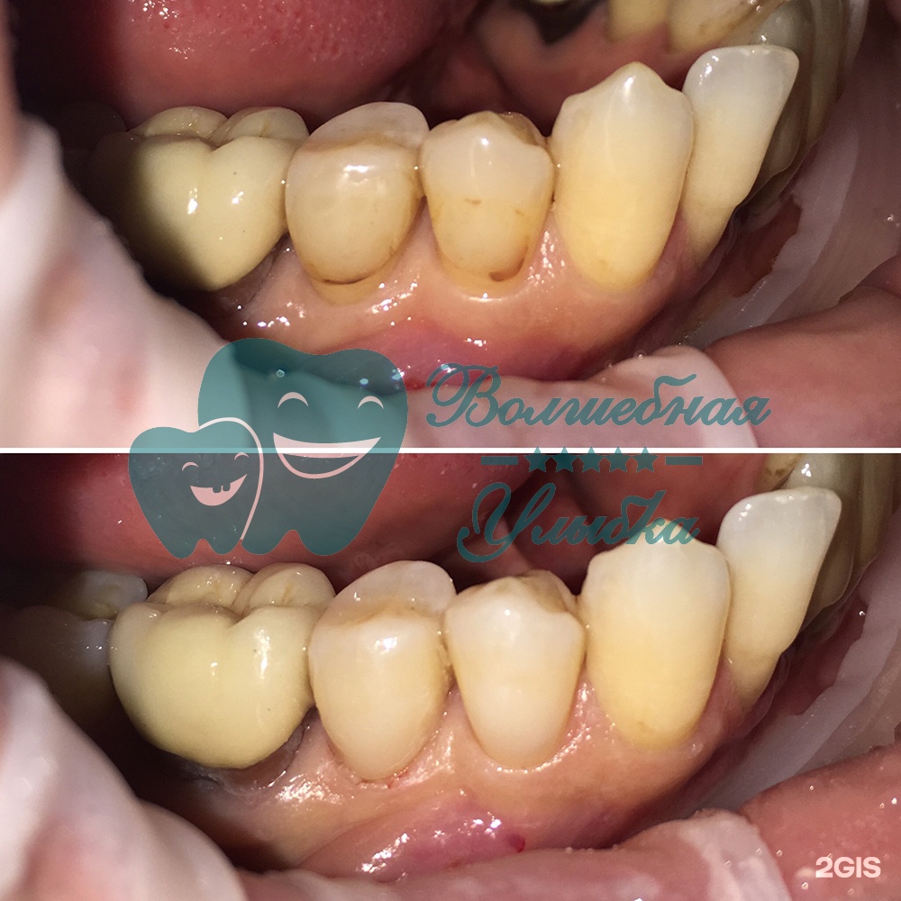 Выше гор Инегень - фото 62