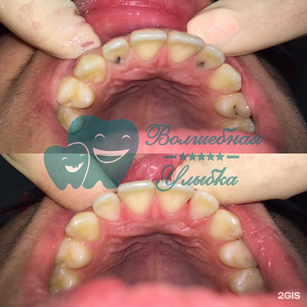 Выше гор Инегень - фото 63