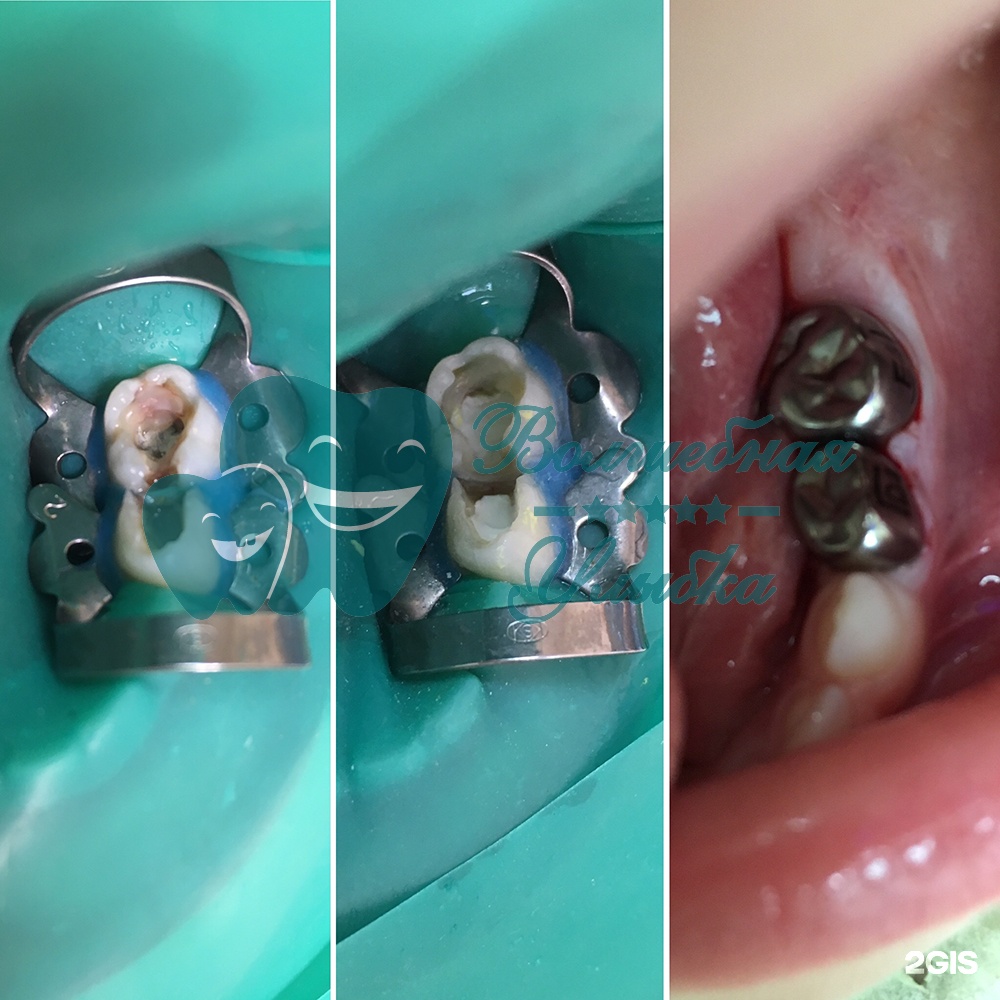 Выше гор Инегень - фото 64