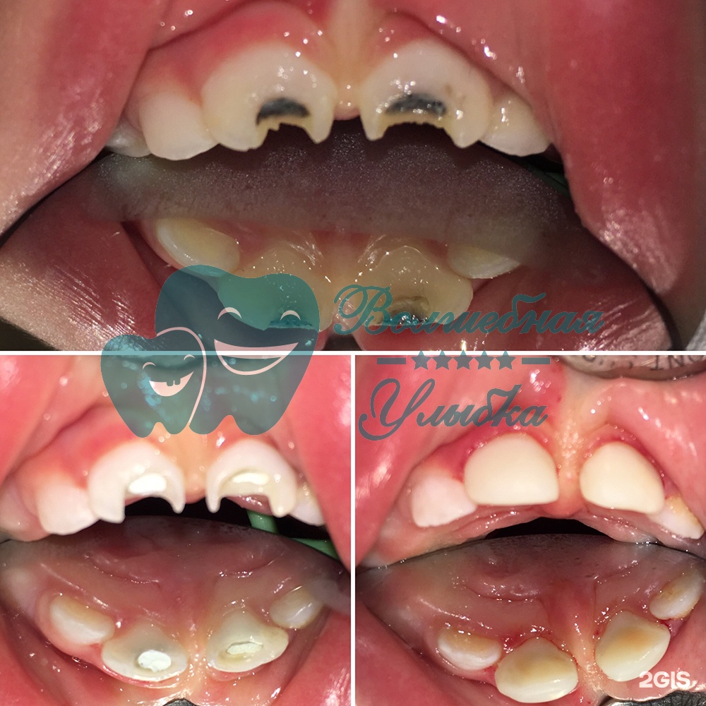 Выше гор Инегень - фото 65